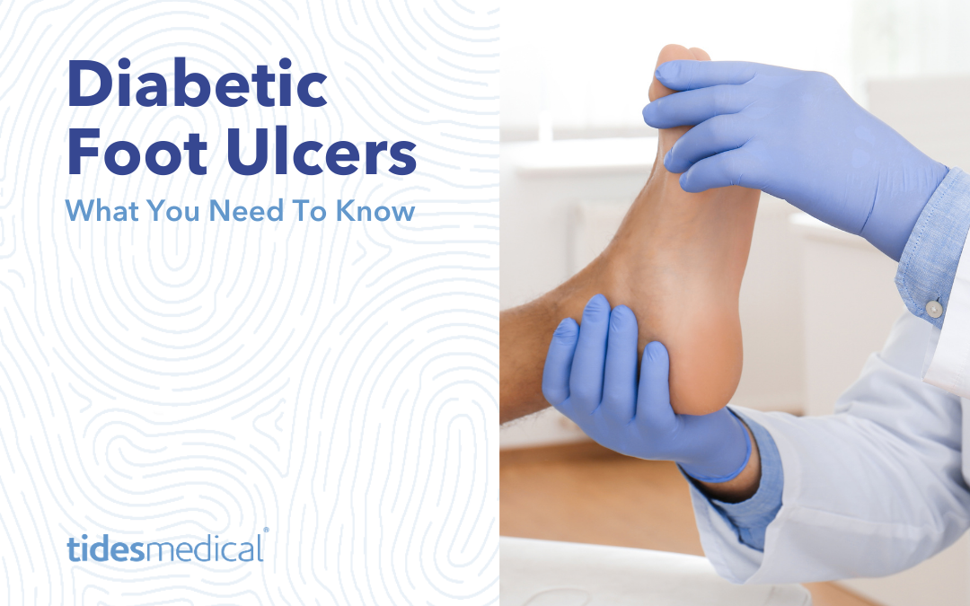 Diabetic Foot Ulcers – What You Need To Know