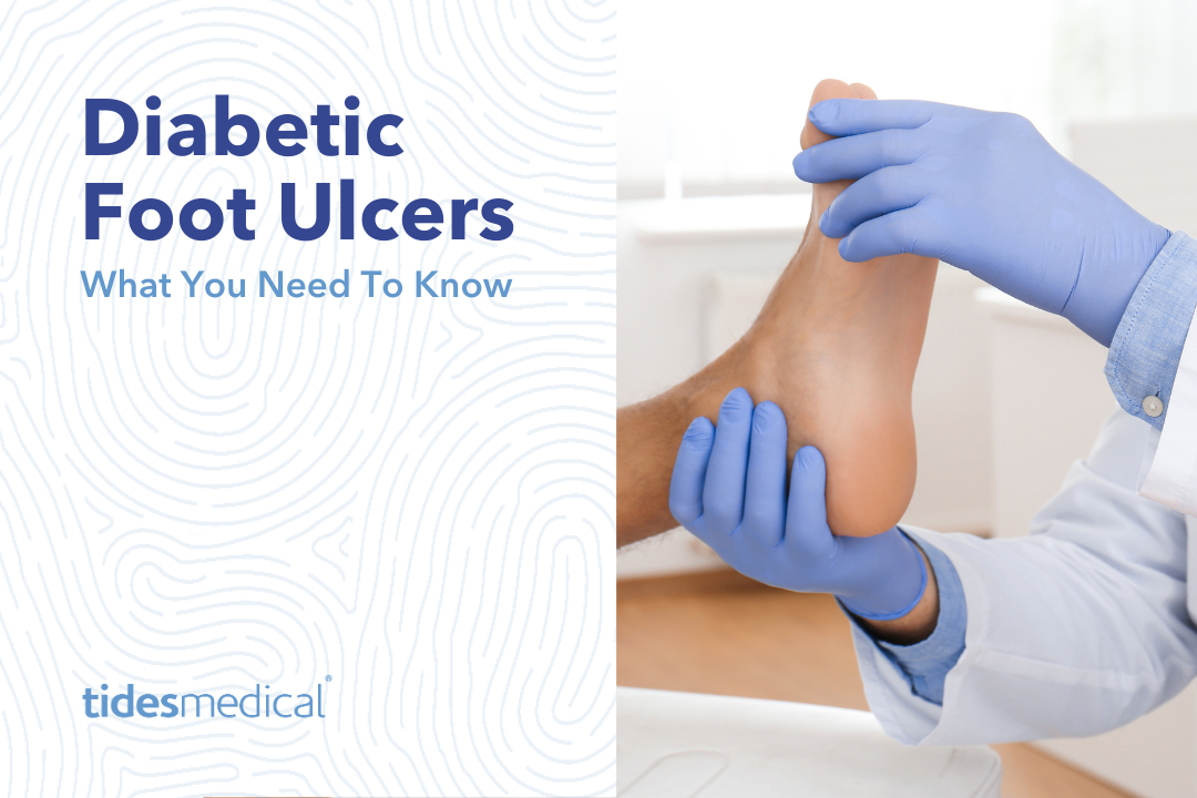 Diabetic Foot Ulcers – What You Need To Know