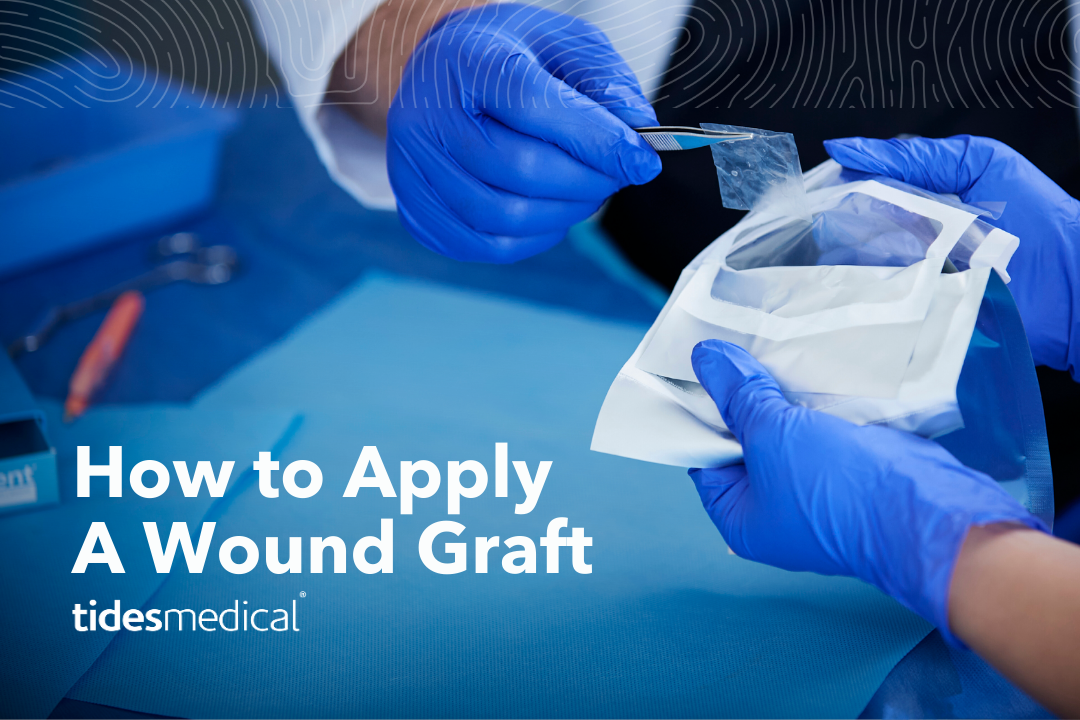 How to Apply A Wound Graft