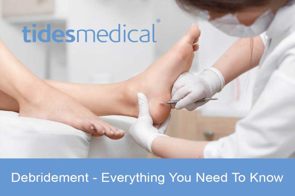 types-of-debridement-everything-you-need-to-know-tides-medical