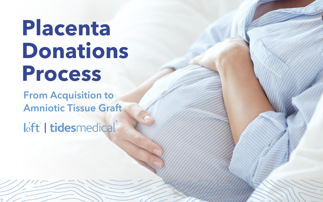 Placenta Donations Process – From Acquisition to Amniotic Tissue Graft