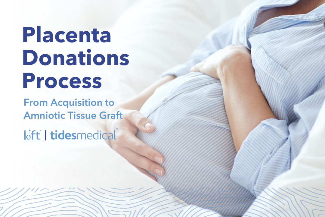 Placenta Donations Process – From Acquisition to Amniotic Tissue Graft