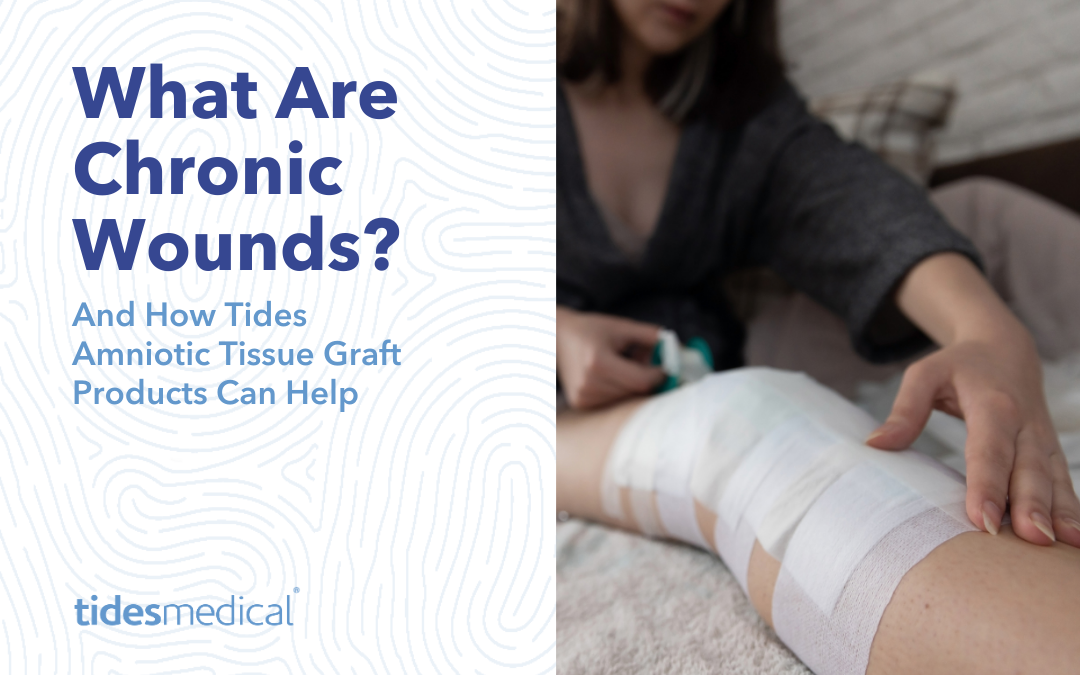 What are Chronic Wounds and How Tides Amniotic Tissue Graft Products Can Help