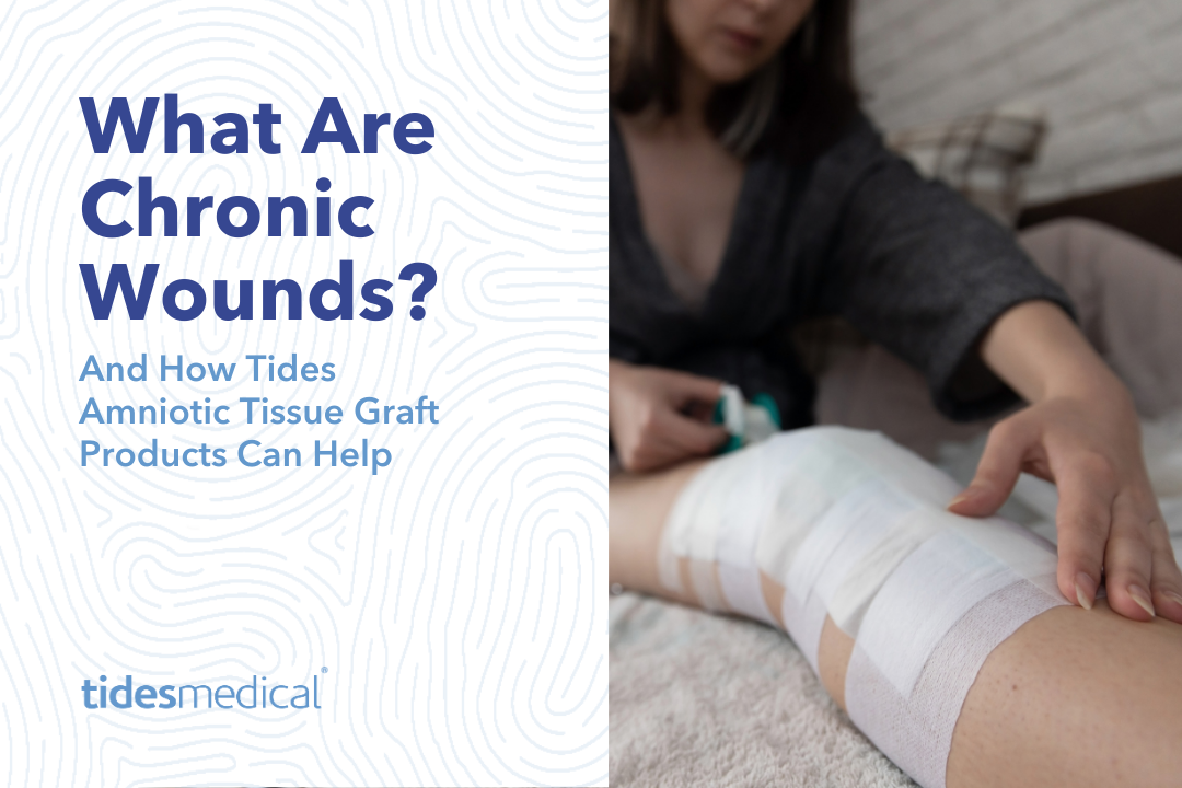 What are Chronic Wounds and How Tides Amniotic Tissue Graft Products Can Help