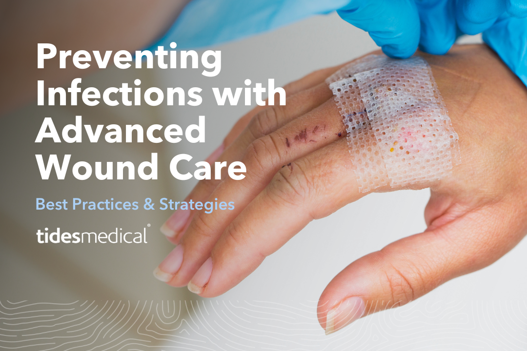 Preventing Infections with Advanced Wound Care: Best Practices & Strategies