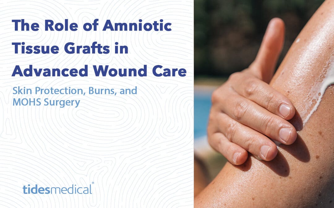 The Role of Amniotic Tissue Grafts in Advanced Wound Care: Skin Protection, Burns, and MOHS Surgery