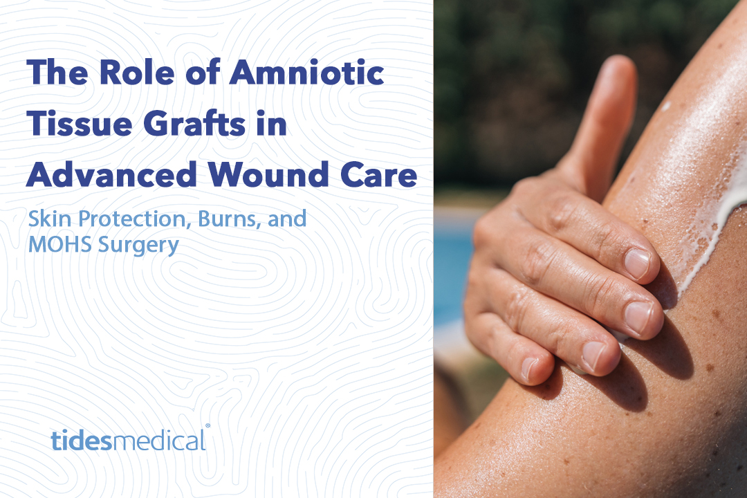 The Role of Amniotic Tissue Grafts in Advanced Wound Care: Skin Protection, Burns, and MOHS Surgery