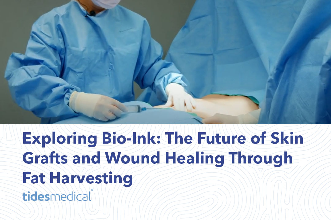 Exploring Bio-Ink: The Future of Skin Grafts and Wound Healing Through Fat Harvesting